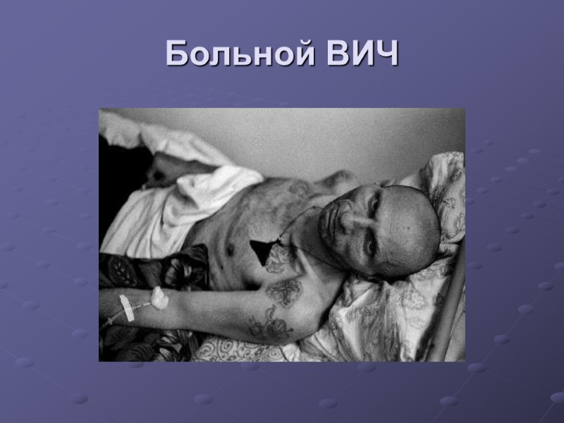 Больной ВИЧ